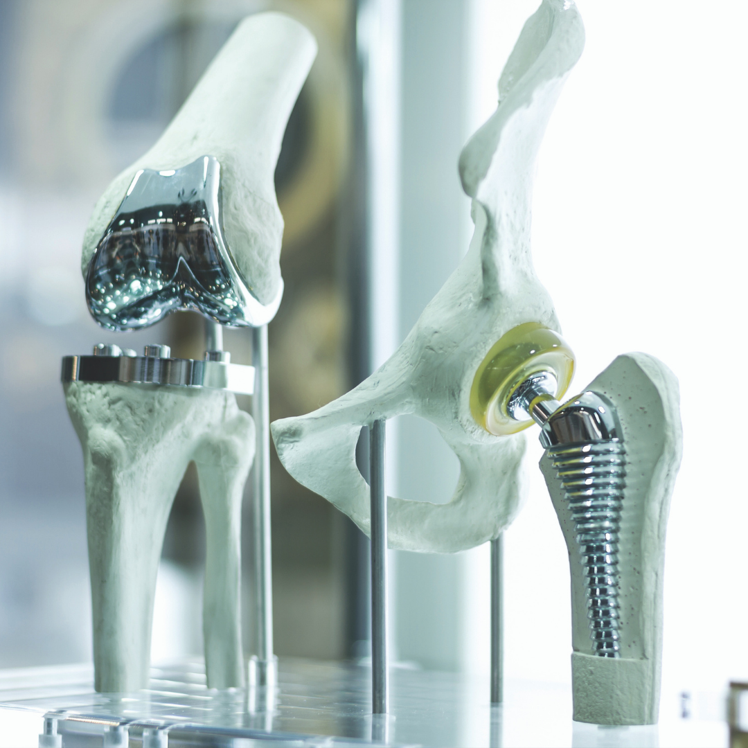 Advances in Arthritic Joint Replacement